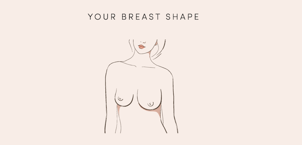 asymmetric breasts